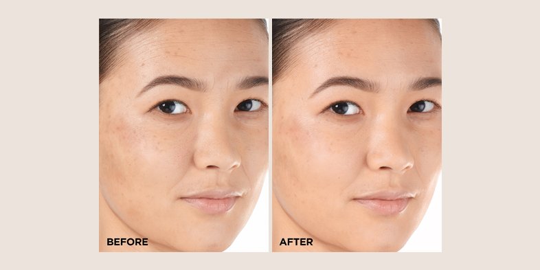 In Article How To Hide Large Pores VitaminC